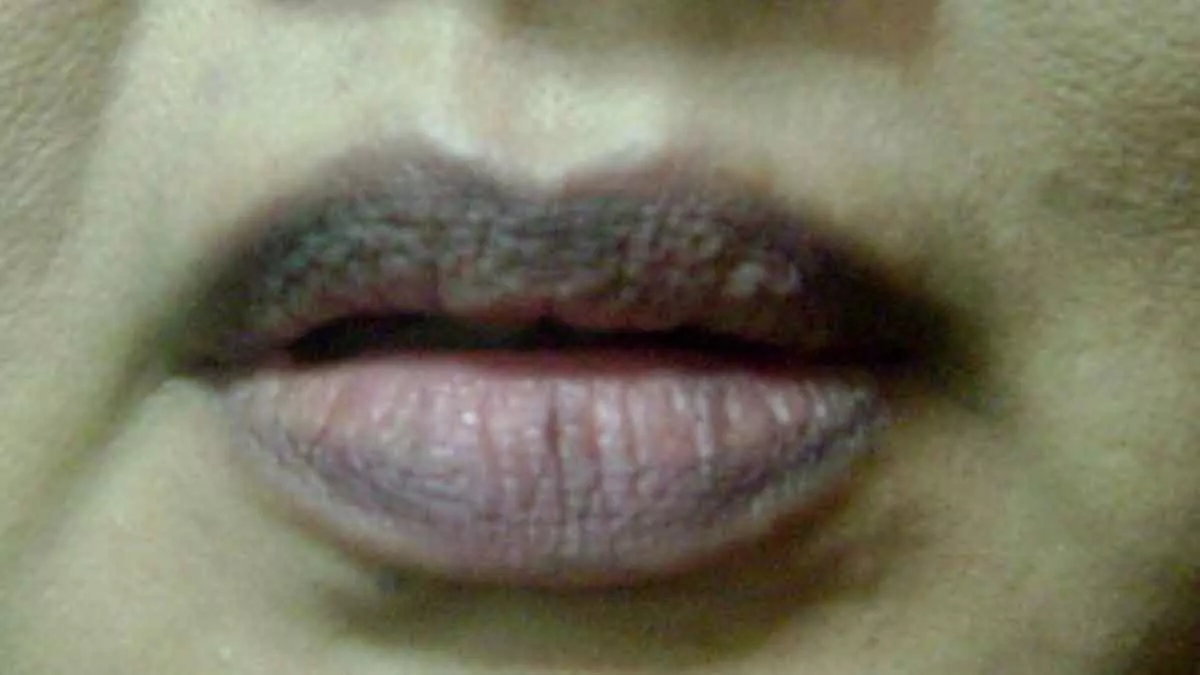 Cegah Bibir Menghitam dengan 5 Cara Ini