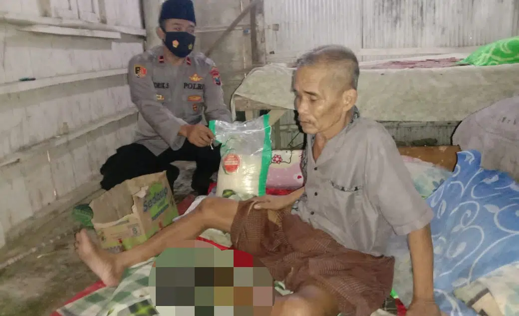 Injak Tulang Ular, Pria Paruh Baya Menderita Infeksi Tulang