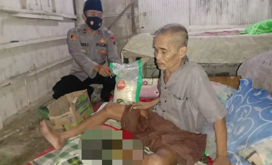Injak Tulang Ular, Pria Paruh Baya Menderita Infeksi Tulang