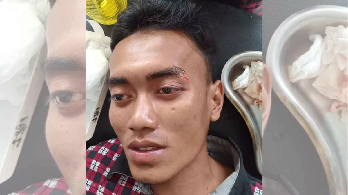 Antri Mau Mandi, Pemuda Sumenep Malah Dihajar Hingga Babak Belur