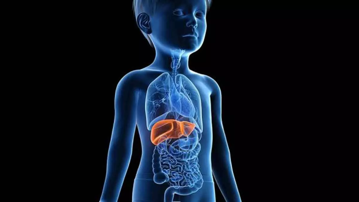 Hepatitis Akut Misterius Serang Anak, Masyarakat Tak Perlu Panik