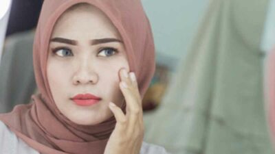 Begini Doa Hilangkan Jerawat dalam Islam