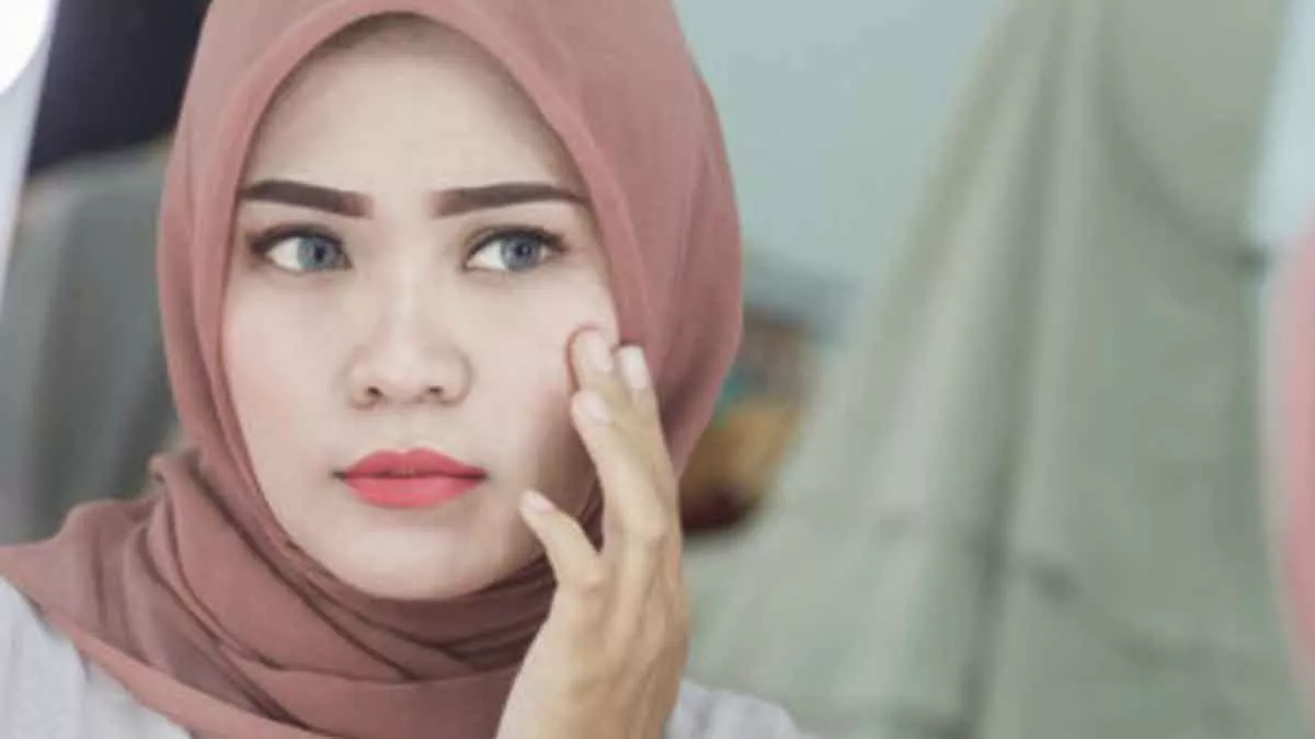 Begini Doa Hilangkan Jerawat dalam Islam