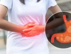 Asam Lambung Naik? Ini Penyebabnya dan 4 Cara Mengatasinya