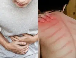 Ini Dia Penyebab dan Ciri-ciri Masuk Angin dan Cara Mengatasinya