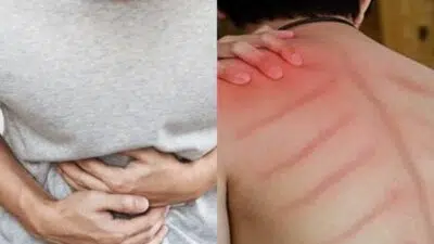 Ini Dia Penyebab dan Ciri-ciri Masuk Angin dan Cara Mengatasinya