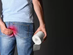 7 Cara Mengatasi Wasir Berdarah dengan Cepat dan Mudah
