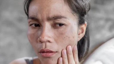 Terungkap! Rahasia Kulit Cerah Alami: Bahan Dapur Bikin Wajah Kusam Auto Glowing!